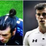 bale bald